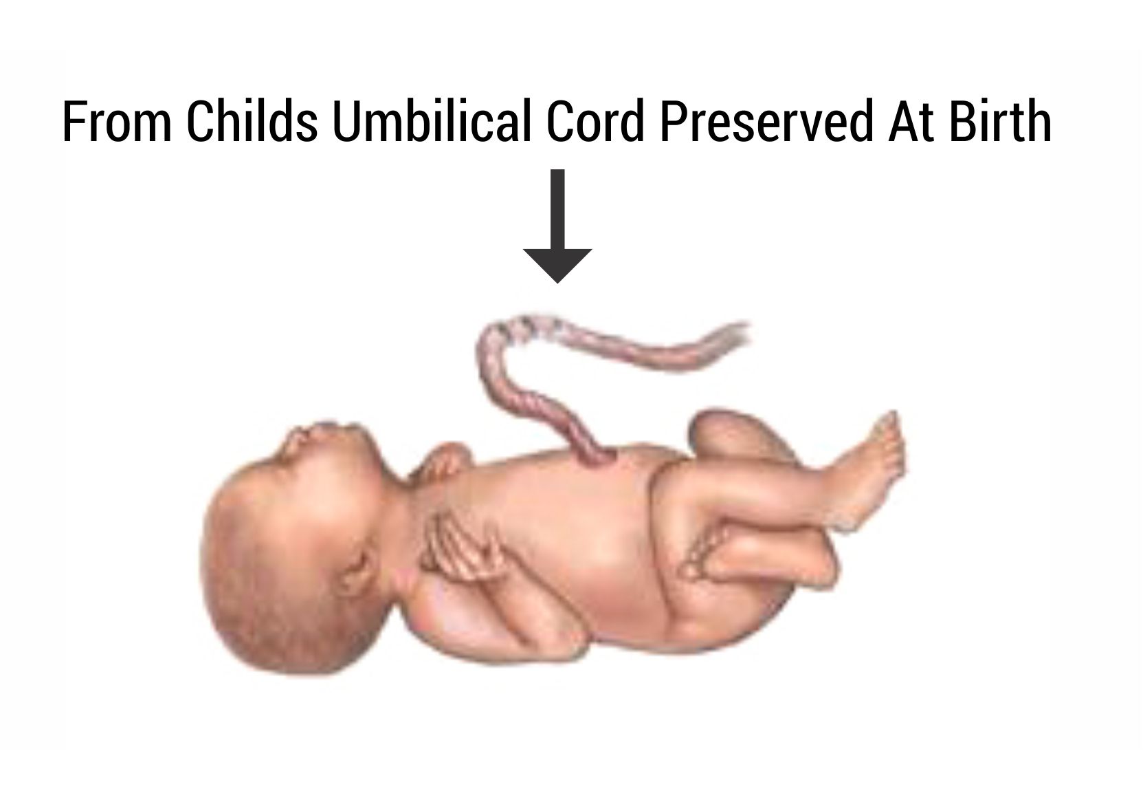 Childs Umbilical Cord, Stem Cell Treatment For Autism, Stem Cell Treatment In Autism, Autism Connect